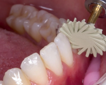 Miniatura: Polidor twist EVE fino