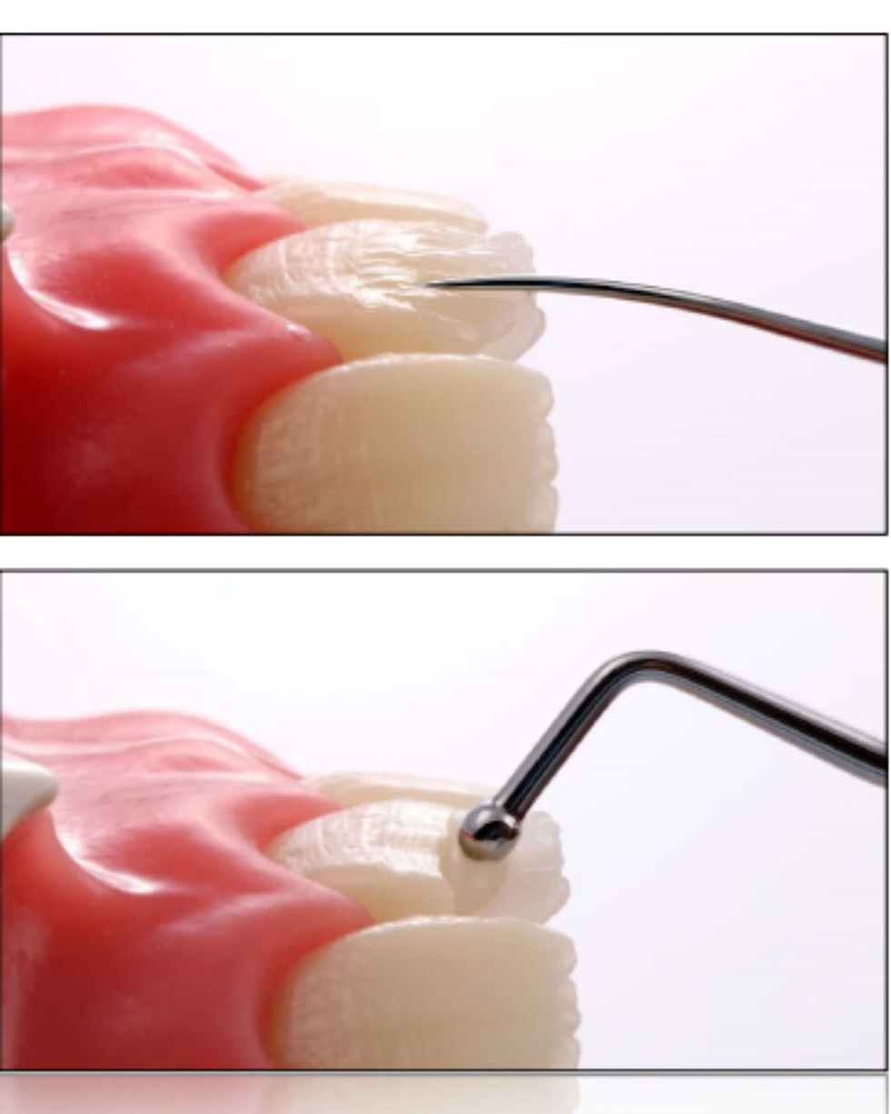 Miniatura: espatula odontologica composite shape spot acabamento resina composta