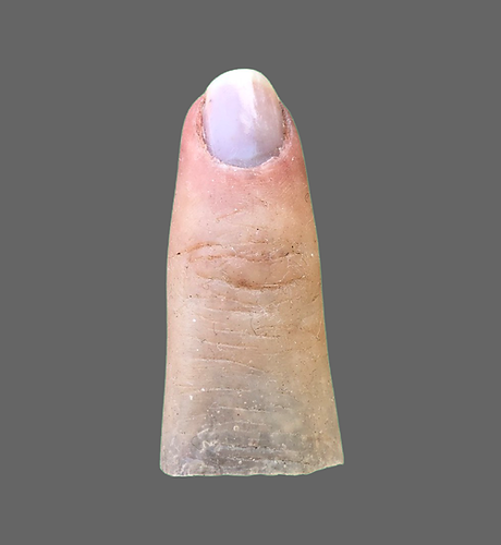 3 FINGER Prosthesis.PNG