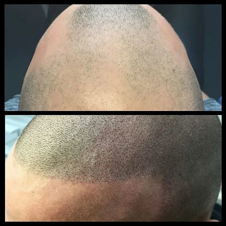 haarpigmentierung smp ravensburg horgenzell aesthetic atelier