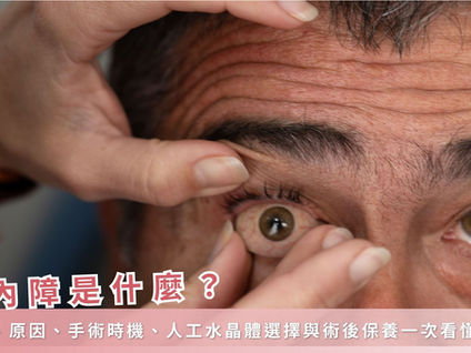 白內障是什麼？症狀、原因、手術時機、人工水晶體選擇與術後保養一次看懂