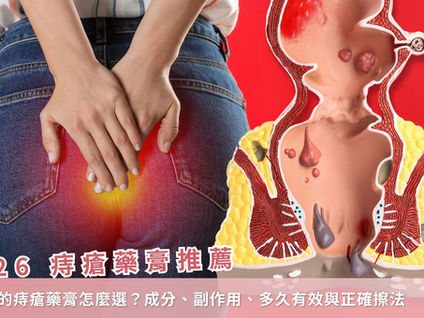 2026 痔瘡藥膏推薦：最有效的痔瘡藥膏怎麼選？成分、副作用、多久有效與正確擦法