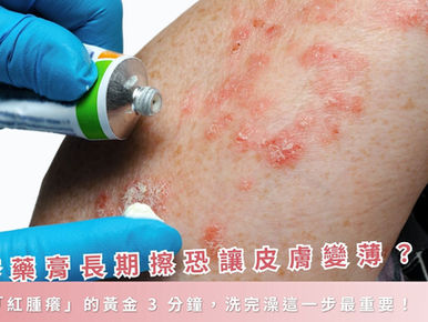 濕疹藥膏長期擦恐讓皮膚變薄？擺脫「紅腫癢」的黃金 3 分鐘，洗完澡這一步最重要！