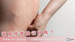 皮膚癢一粒一粒紅紅的？一文看懂蕁麻疹原因與不能吃什麼！