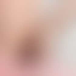 皮膚癢一粒一粒紅紅的？一文看懂蕁麻疹原因與不能吃什麼！