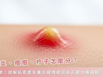 毛囊炎、痘痘、疔子怎麼分?別亂擠!詳解私密處毛囊炎硬塊成因與正確治療邏輯