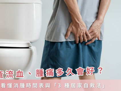 痔瘡流血、腫痛多久會好？一文看懂消腫時間表與「3 種居家自救法」