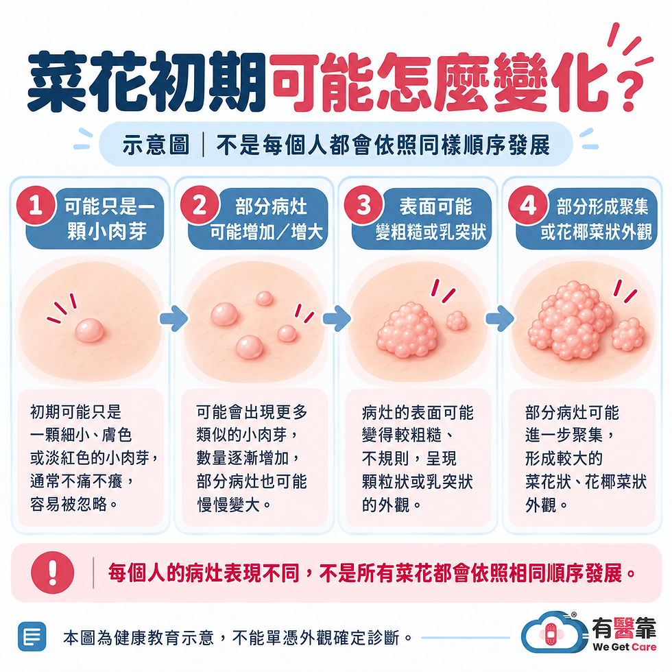 菜花可能從細小肉芽、丘疹逐漸增加或形成乳突狀病灶的外觀變化示意圖