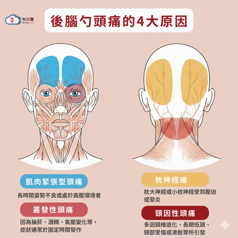 後腦勺頭痛的4大原因