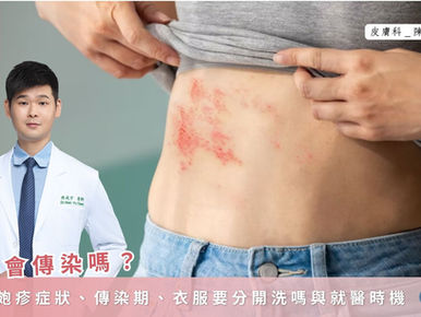 皮蛇會傳染嗎？帶狀皰疹症狀、傳染期、衣服要分開洗嗎與就醫時機