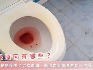 血尿原因有哪些？一定是癌症嗎？男女血尿、尿潛血與檢查方式一次看