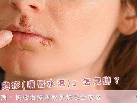 唇皰疹 (嘴唇水泡) 怎麼辦?傳染期、快速治療與飲食禁忌全攻略