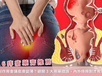 2026 痔瘡藥膏推薦|類固醇副作用會讓皮膚變薄?避開3大用藥錯誤,內外痔擦對才有效