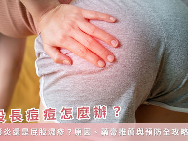 屁股長痘痘怎麼辦？是毛囊炎還是屁股濕疹？原因、藥膏推薦與預防全攻略