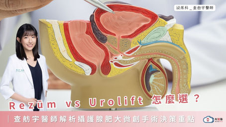Rezūm vs Urolift 怎麼選?查舫宇醫師解析攝護腺肥大微創手術決策重點