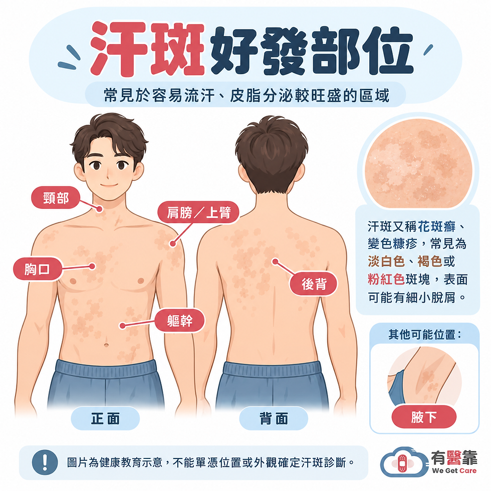 汗斑常見於頸部、胸口、後背、肩膀上臂與軀幹,腋下也可能出現的好發部位示意圖