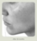 Thumbnail: Adipeau Active Face Cream