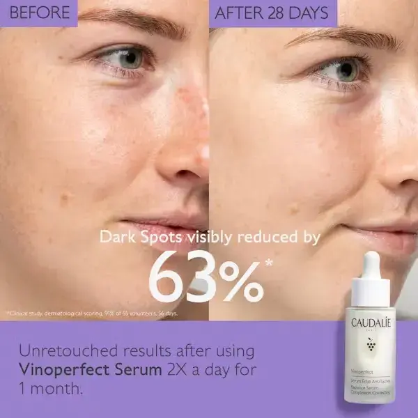 Thumbnail: Radiance Dark Spot Serum Vitamin C Alternative