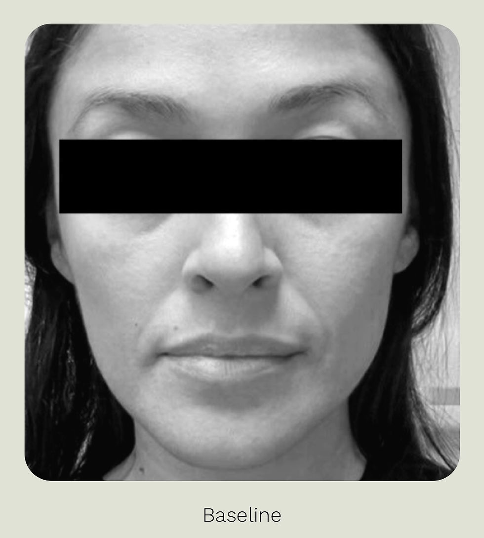 Thumbnail: Adipeau Active Face Cream