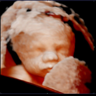 Pretecho Westland Babybad Rotterdam Delfland Monster