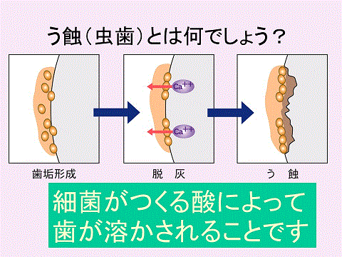 武蔵境駅徒歩２分の歯医者,すきっぷ通り,歯周病,ホワイトニング,妊婦,口腔外科,小児歯科,武蔵野市,顎関節症,土曜