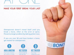 骨折の危険性の高い患者さんとは・・・