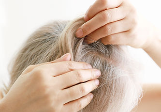 woman checking her hairline