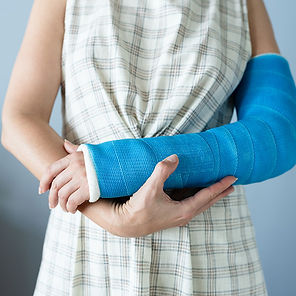 Close-up of the broken arm of a woman