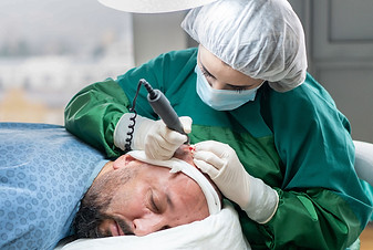 Hair transplant surgery in progress