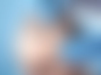 Hair transplant, Hair transplant Turkey, Fue Hair Transplant