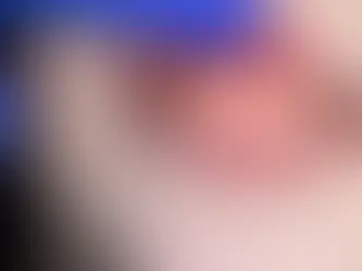 "OTOİMMUN HASTALIKLAR, DİŞ ETİ KANAMALARINI ETKİLEYEBİLİR"