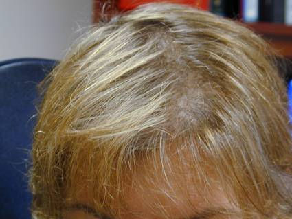 Real science-backed hair growth at Renewing Hair Wellness