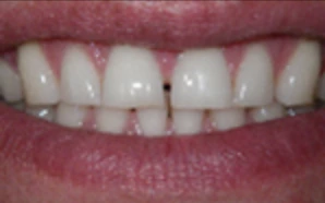 cosmetic dentist in briarcliff manor