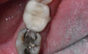 cosmetic dentist in briarcliff manor
