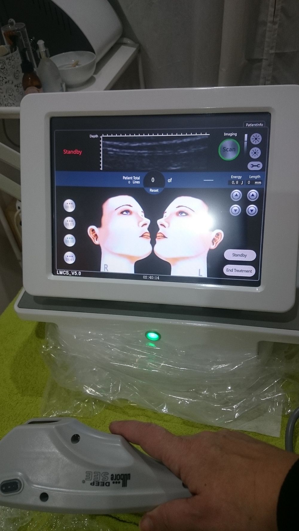 HIFU en Estética Zen