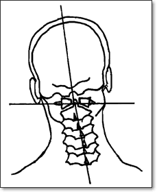 Misalignment of the spine | Beck Spinal Care & Rehab | Car accident doctor Spanish Fork