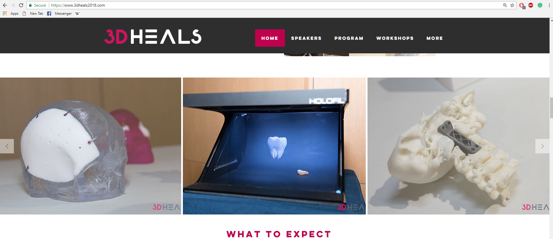 3D heals Dental demo San Fransisco