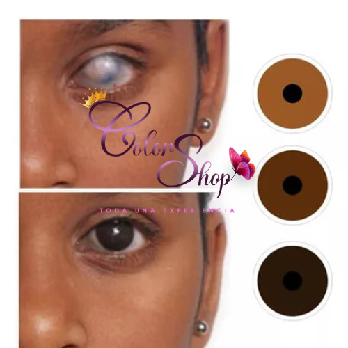 Lente de Contacto Protesico