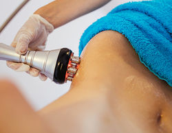 RF-Body-Tightening-1