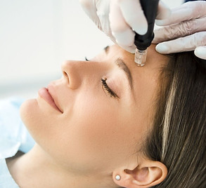 anti-a-ge-tout-connai-tre-sur-la-technique-du-microneedling-gala_orig.jpeg