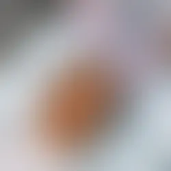 What is the Process of Getting Botox in Wheaton, IL?