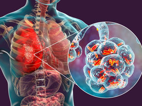 ሚያዝያ 11፣2016 - በሲዳማ ክልል የቲቢ ስርጭት ከፍተኛ መሆኑ ተነገረ