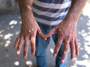 ነሐሴ 10፣2016 - የባህር ማዶ ወሬዎች