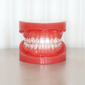 invisalign cannes le cannet