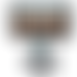 iTero Lumina Scanner used at JD Dentistry for smile design for Composite bonding