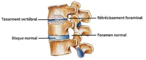 Foramen