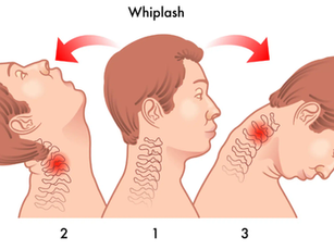 Whiplash ou coup du lapin