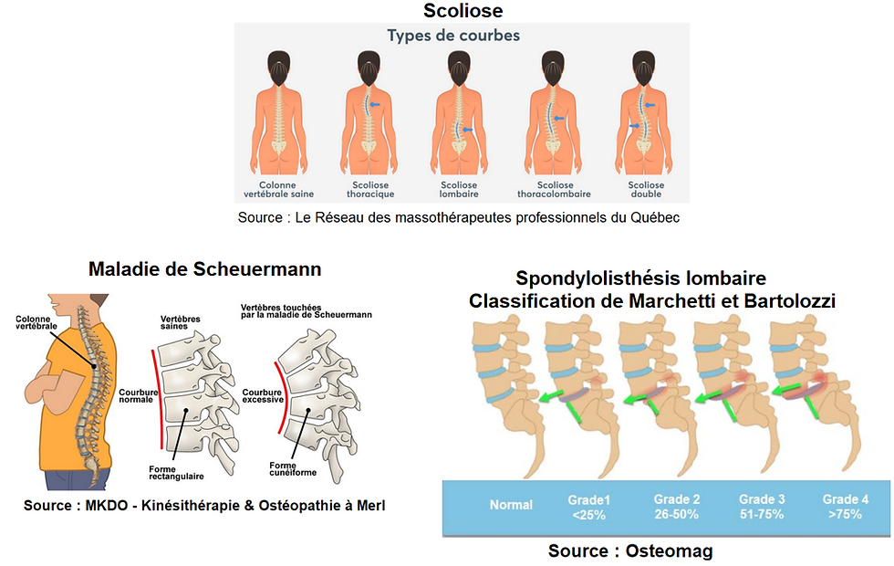 Différents types des trouble rachidiens