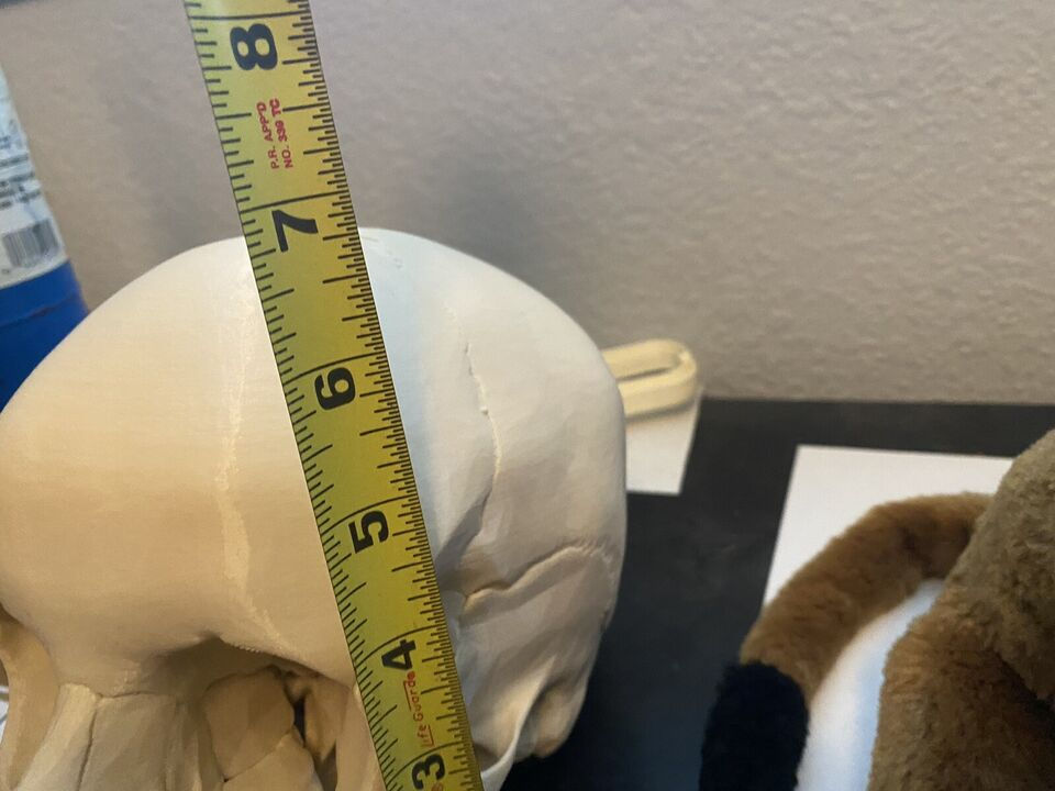 Thumbnail: Life Size Human Skull Replica
