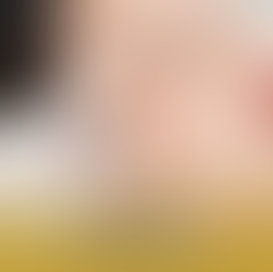 ความเชื่อผิดๆ ที่ควรรู้ก่อนฉีดโบ